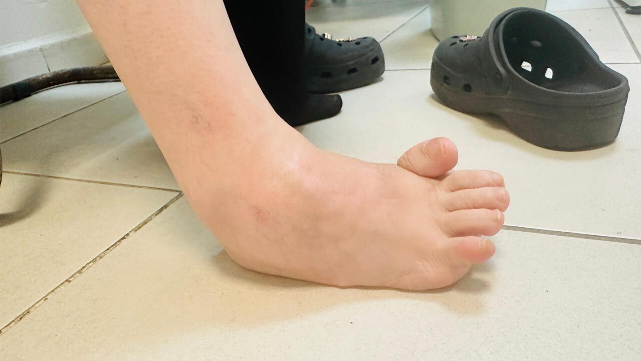 Cankirili Doktor 51 Yil Sonra Ilk Ayakkabisini Giydirdi
