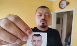 Saçlarını siyahlatmak için aldığı şampuan arı sokmasından beter hale getirdi