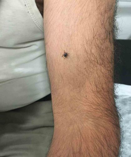 Kayseri’nin bir ilçesinde daha kene vakası