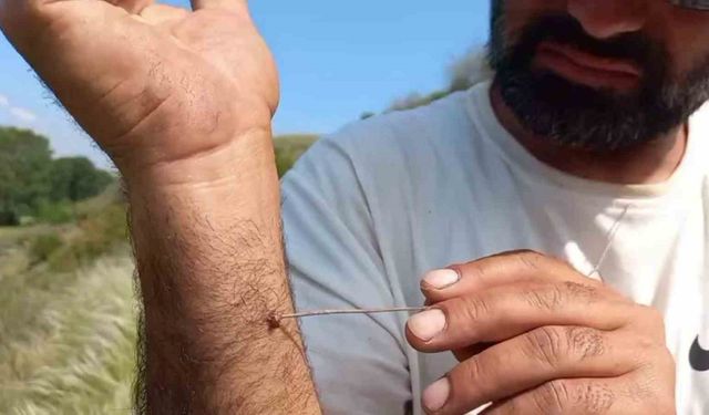 Uzmanı uyardı: "Kenenin vücutta kalma süresi hastalığın bulaşma riskini yükseltiyor"
