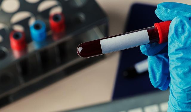 17 aylık kit (şişe) karşılığı kan kültürü şişe cihaz temini